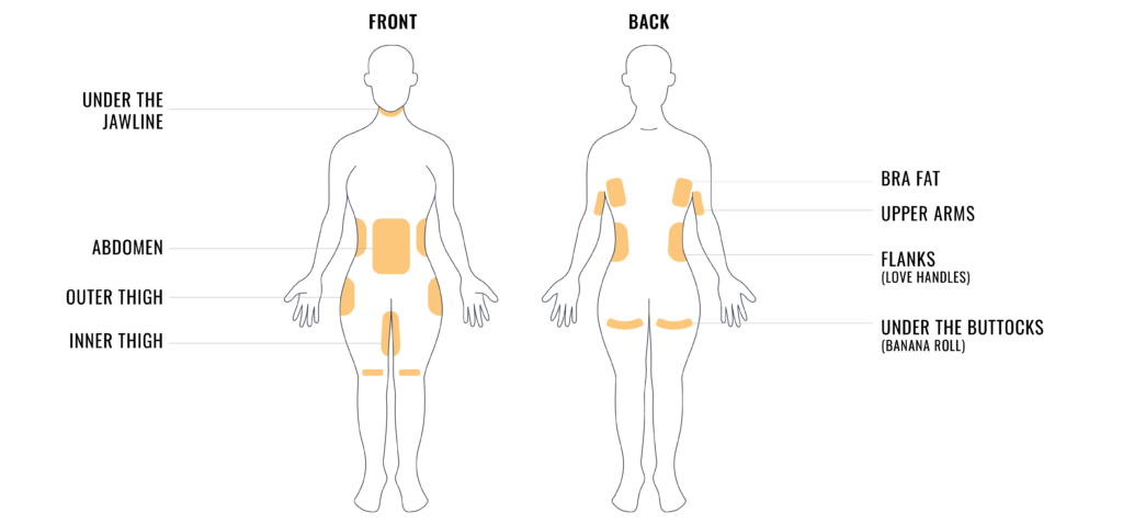 coolscultping targeted fat loss