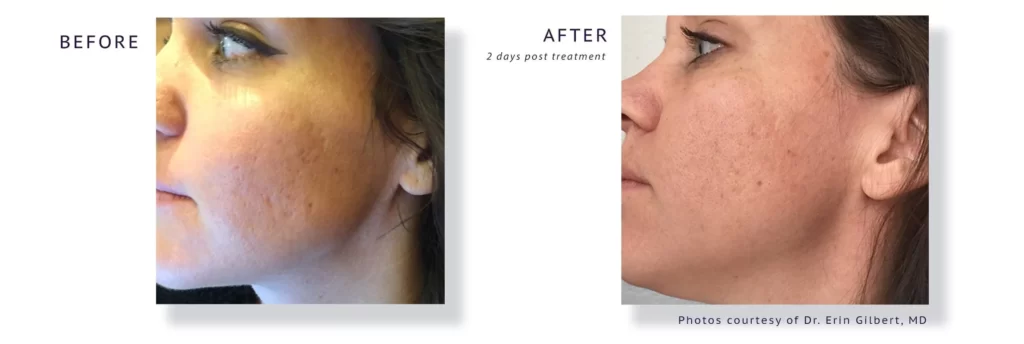3 a3ce448d 959f 4a3a 8995 a64e88b72595 2376x Maya Medi Spa | Best Beauty Clinic in India