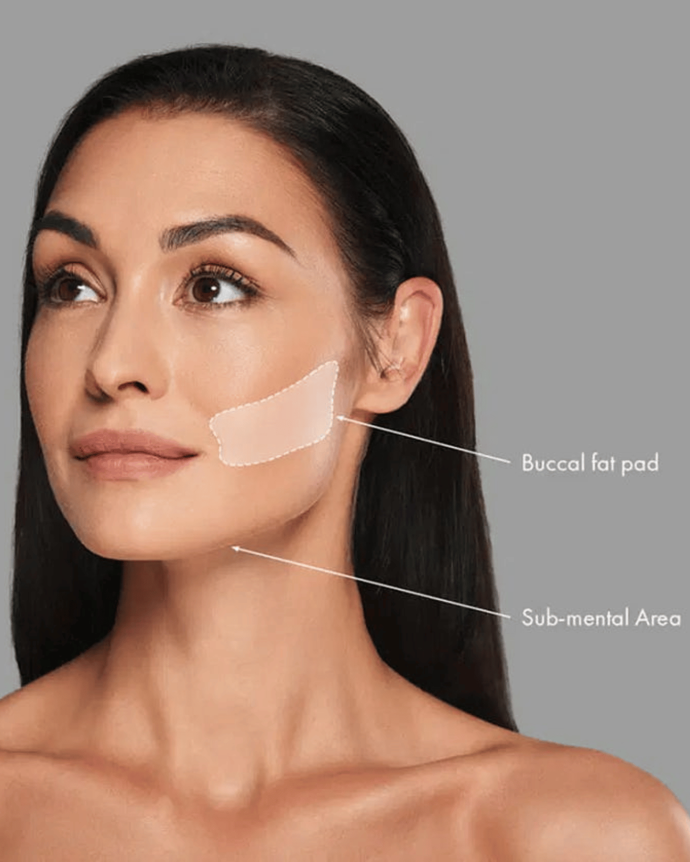 Buccal Fat Removal 1 Buccal Fat Removal Maya MediSpa 1 Maya Medi Spa | Best Beauty Clinic in India