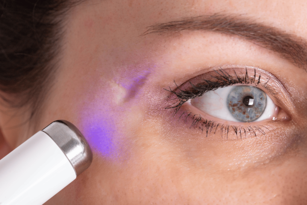 Scar Correction 3 Key Benefits of Scar Correction at Maya MediSpa Maya Medi Spa | Best Beauty Clinic in India