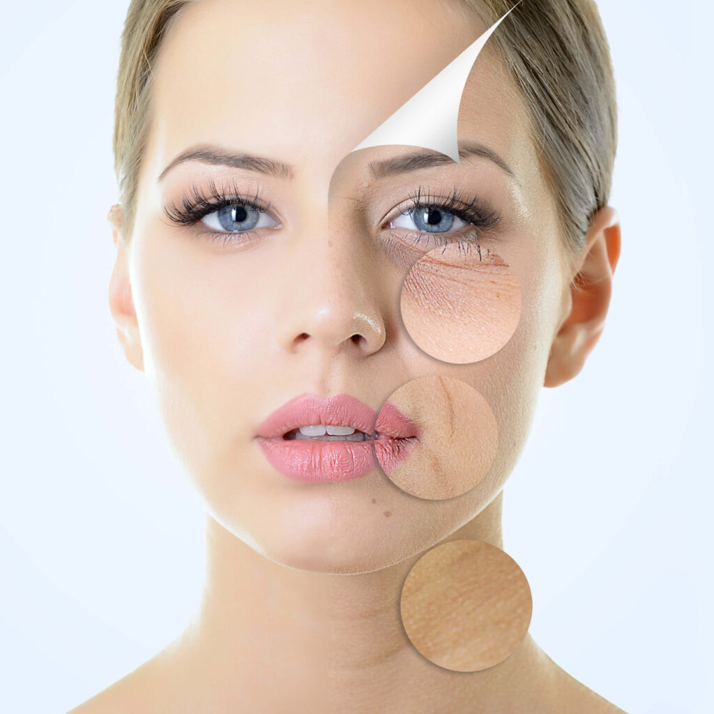 SCULPTRA 2 Sculptra Maya Medi Spa | Best Beauty Clinic in India
