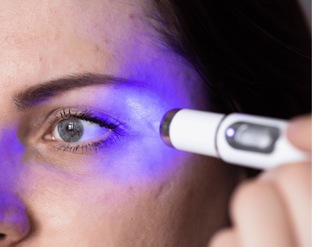 Scar Correction 2 Understanding Scar Correction Maya Medi Spa | Best Beauty Clinic in India