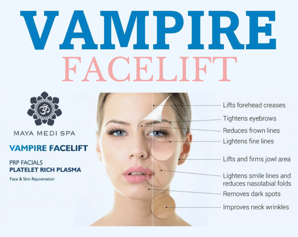 Vampire Facelift 2 VAMPIRE FACELIFT BY MAYA MEDISPA Maya Medi Spa | Best Beauty Clinic in India